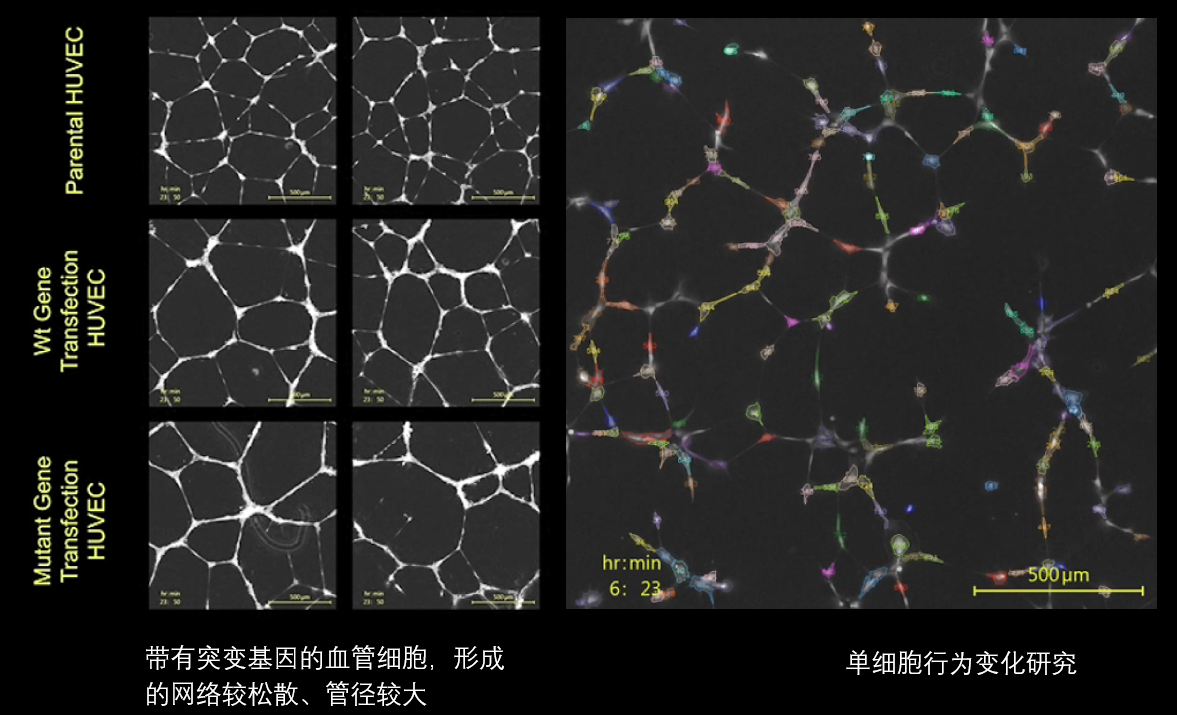 6、血管分析.png